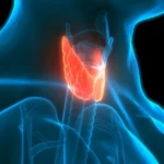Thyroid Cancer