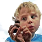 Lazy Eye (Amblyopia)