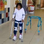 Spina Bifida: Causes, Types, and Treatment