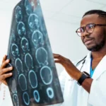 Transient Ischemic Attack (TIA)