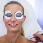 Understanding laser treatment for tightening skin