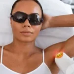 Understanding laser pigmentation removal for dark skin