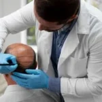 Understanding hair transplants: What you need to know