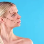 Exploring non-surgical facelift options for youthful skin
