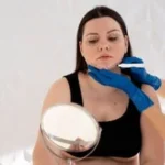 Understanding CoolSculpting for a Double Chin