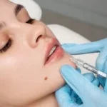 Exploring the art of permanent lip contouring
