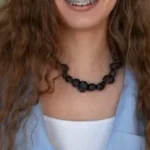 Understanding plastic braces: benefits, options, and care
