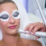 Exploring the world of facial laser clinics