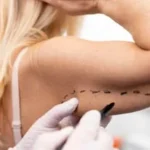 Understanding scar removal clinics and their options
