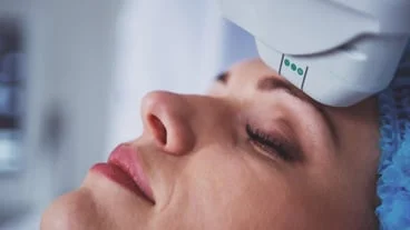 Understanding under eye dark circle laser treatment: A comprehensive guide