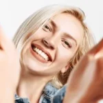Achieving the perfect smile with veneers